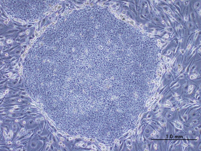 iPS細胞（分化前）